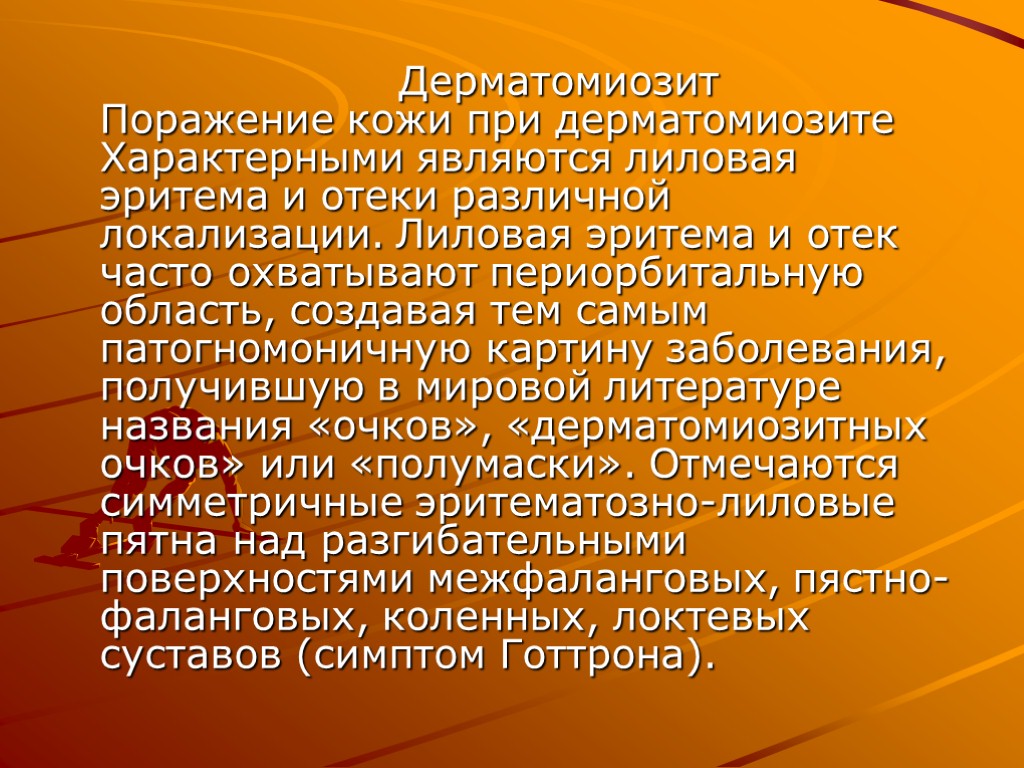 Дерматомиозит Поражение кожи при дерматомиозите Характерными являются лиловая эритема и отеки различной локализации. Лиловая